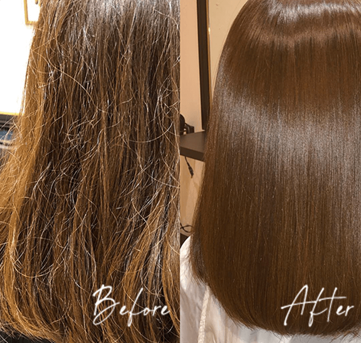 施術後のBefore After画像①